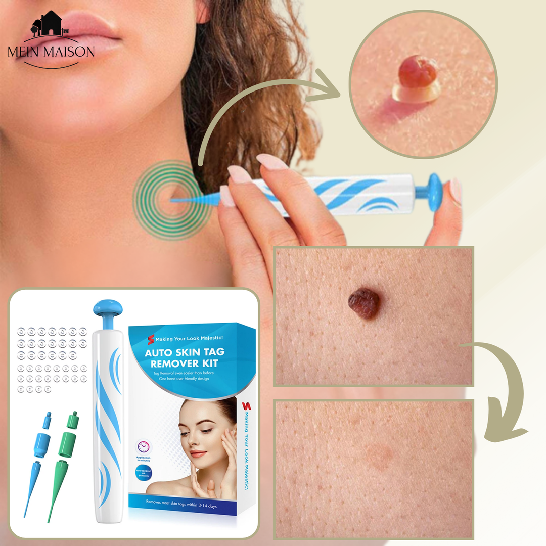 DermaLinx Wart Remover | Painless Removal of Warts and Moles | For Home Use | No Surgery