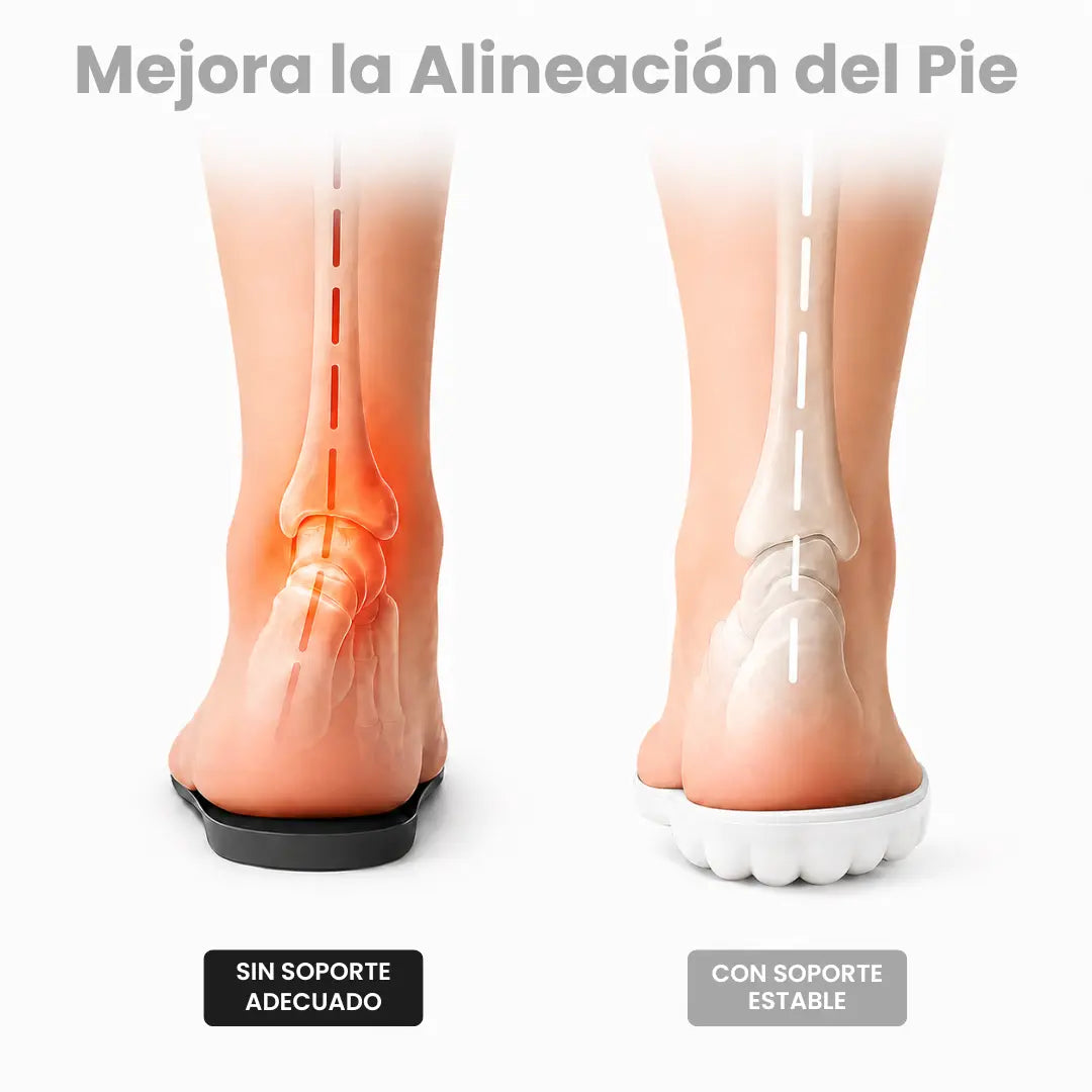 Orthopedic Insoles for Heel Spurs and Plantar Fasciitis