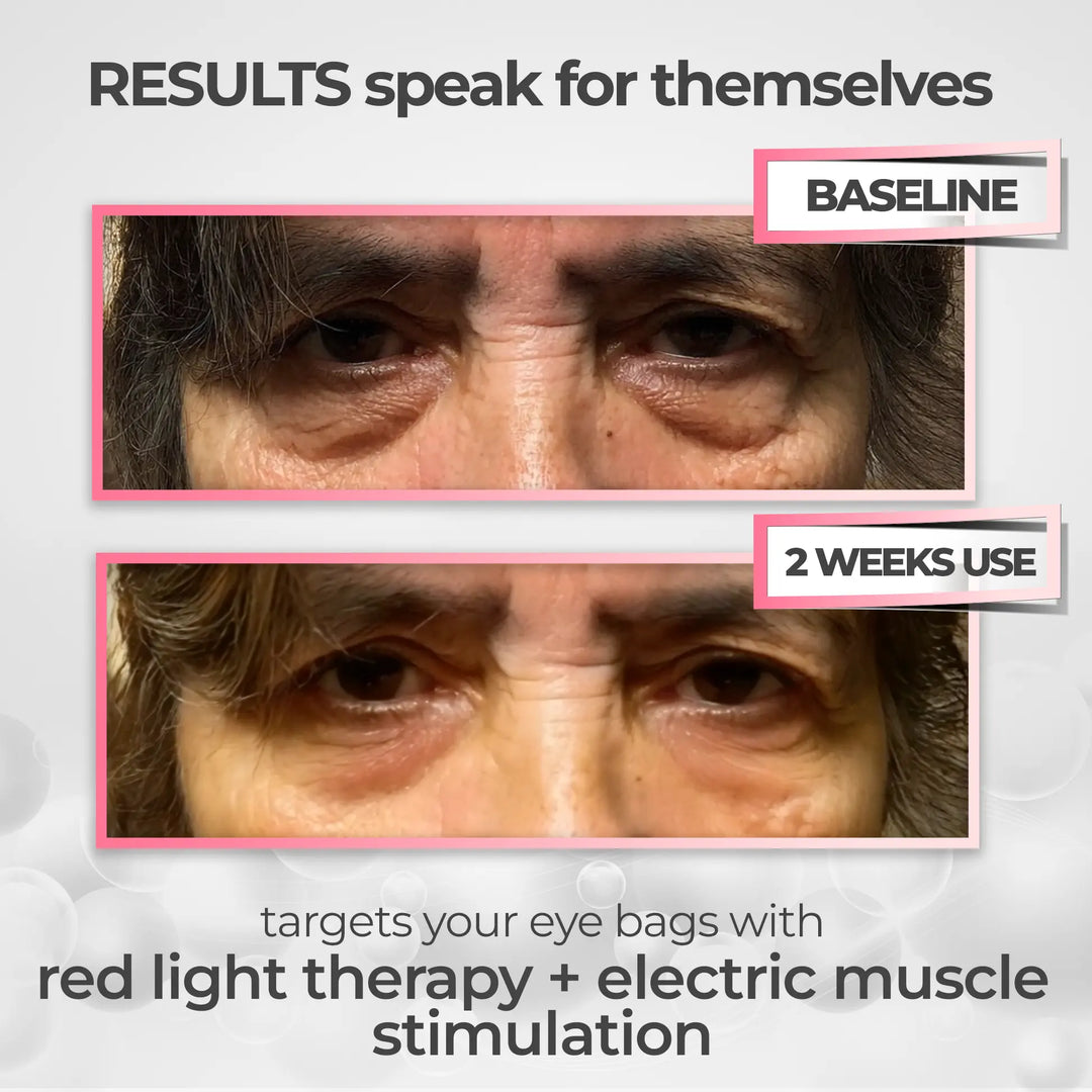 LumaNova Eye Rejuvenator for Red Light and Microcurrent Therapy