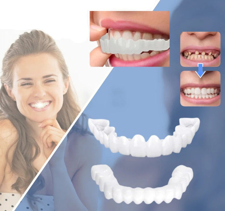 Snap-On Veneers | Flexible, Glue-Free Fit for Meals and Everyday Wear